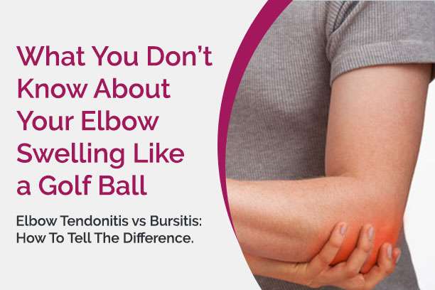 Why Is Your Elbow Swelling Like A Golf Ball? | MVMT Physio & Chiro