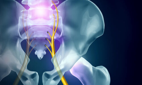 physiotherapy for sciatica st albert
